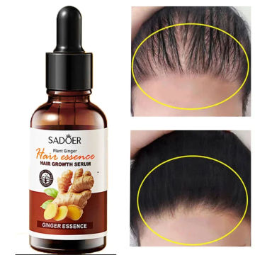 Anti Hair Loss Prevent Hair Dry Thinning Scalp Repair  Ginger Hair Growth Serum Fast Essential Oil  Product