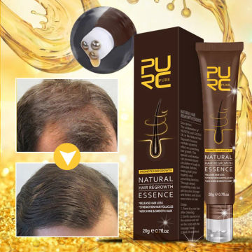 PURC Ginger Hair Growth Products Hair Regrowth Serum Thickening Prevent Hair Loss Treatment for Men Women Beauty Health Care