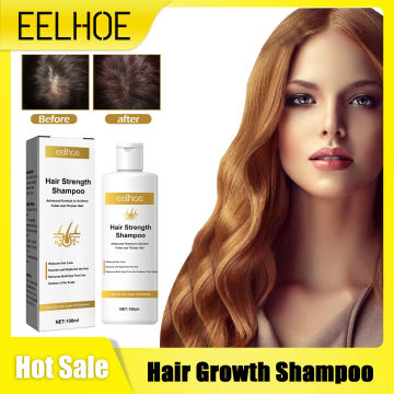 Hair Growth Shampoo Thickening Strengthen Clean Scalp Treatment Dandruff Remover Itchy Relief Oil Control Anti Hair Loss Product