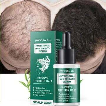 Hair Growth Products Prevent Hair Loss Essential Oil Fast Growing Anti-Drying Scalp Treatment Repair Beauty Health for Men Women