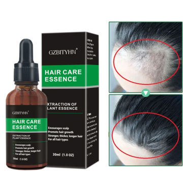 Ginger Hair Growth Oil Huile Pousse Cheveux Rapides Crecimiento De Cabello Para Hombres Tratamiento Capilar Aceite Crece Pelo