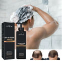 Root Activating Shampoo For Men Shampoo Deep Cleans Refreshes Scalp Hair Strengthening Shampoo For All Hair Types A7r5