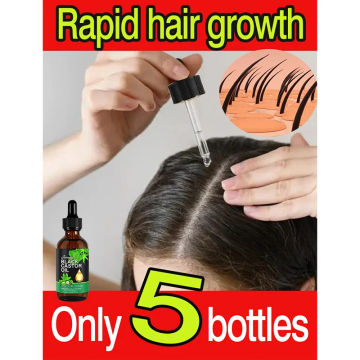 Hair Growth Essential Oil Rosemary Castor Hair Strengthening Oil Nourishing Treatment For Split Ends And Dry Organics Hair Care