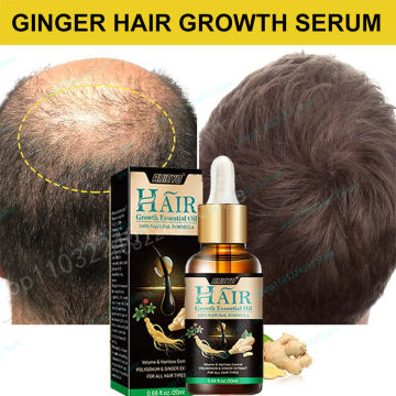 Strong Effect Hair Growth Products Ginger Essential Oil 2 Week Treat Hair Loss Scalp Repair Nourish Hair Roots Regrowth