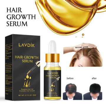 LAVDIK Ginger Fast Hair Growth Serum Essential Oil Anti Prevent Hair Damaged Hair Repair Restoration Growing Shampoo TSLM1