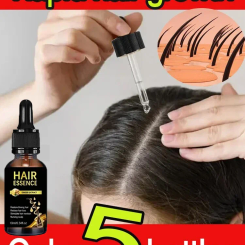 Hair growth oil,effective baldness repair, hereditary hair loss, postpartum hair loss
