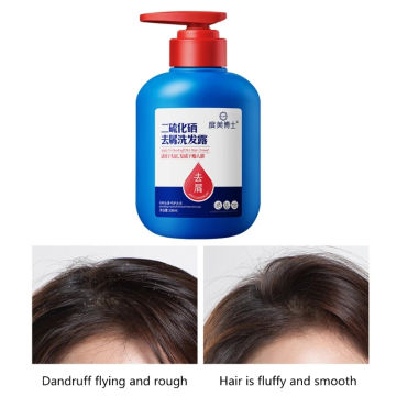 Anti-itching and Anti-dandruff Shampoo Anti-dandruff Oil Control Refreshing Selenium Disulfide Shampoo for Men Women