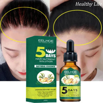 Ginger Hair Growth Essential Oil Effective Prevent Hair Loss Scalp Treatment Increase Hair Products Men Women Fast Anti Alopecia