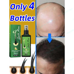 Natural Hair Growth Oil Efficient Anti Hair Loss Nourishing Essential Oil For Dense Repair Damaged Hair Moisturizing Smooth Oil