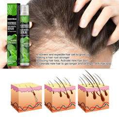 Herbal Fast Hair Growth Serums Spray For Men Anti Hair Loss Regrowth Essence Oil Hair Care Products Capillary growth Sprays