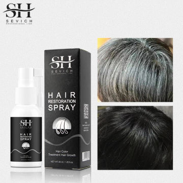 Sevich 30ml Ginger Natural Black Hair Spray Anti-hair Loss Treatment Black Hair Color Dye Hair Growth Product Hair Care Hot