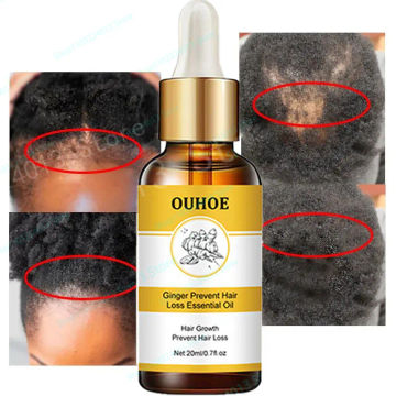 Natural Hair Growth Hair Roots Fast Grow Anti Hair Loss Serum Liquid Scalp Damaged Treatment Repair Beauty Health