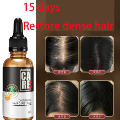 Hair growth solution for preventing hair loss, fixing and densifying hair, magical hairline, hair growth and growth