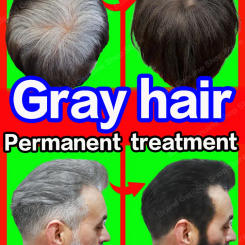 Anti Gray Hair Serum Remedy