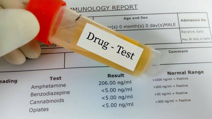 Will Suboxone Show Up on a Drug Test?