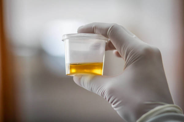 Does Suboxone Show Up on a Urine Test?