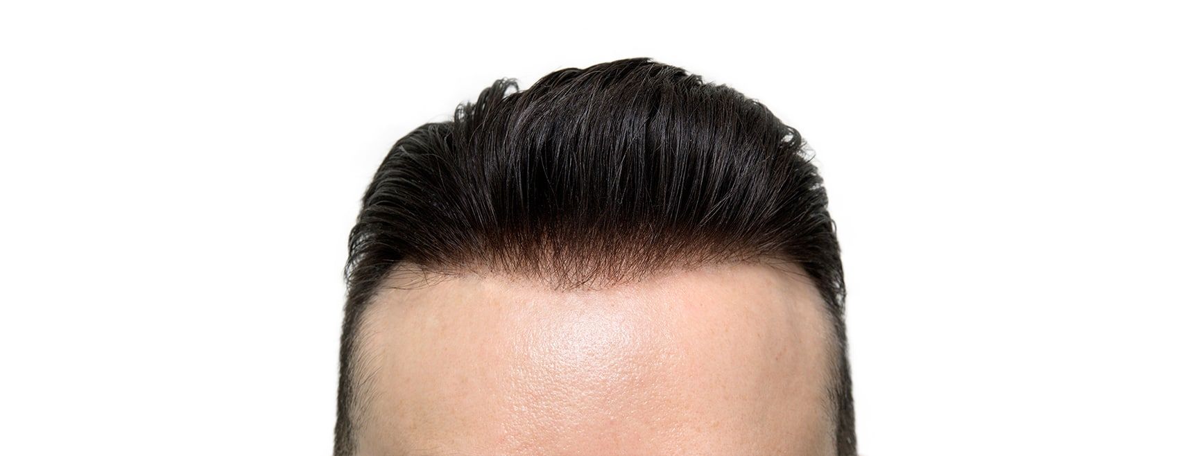 Professional hair system transformation 1