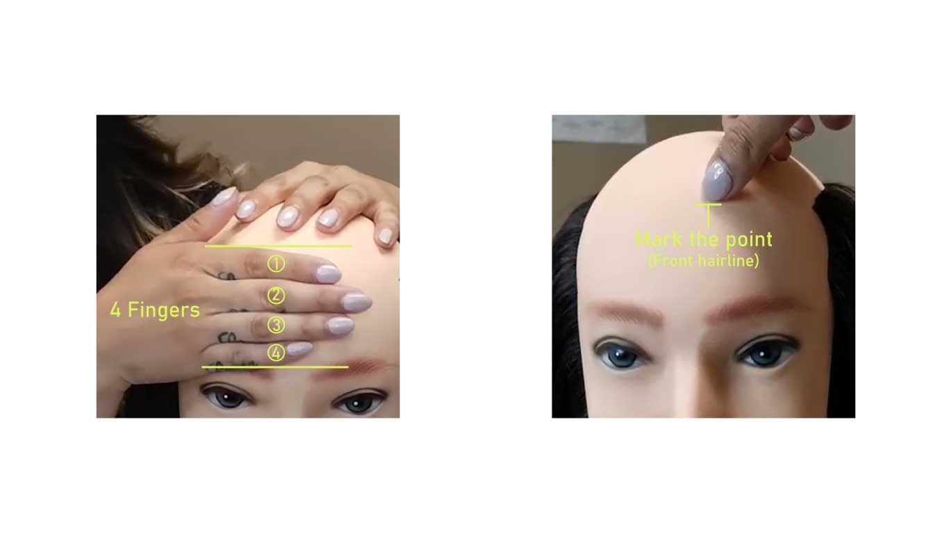 Proper hairline positioning and measurement points