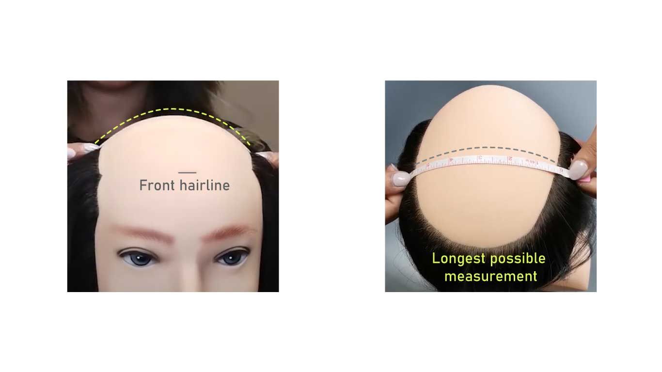 Proper technique for measuring side-to-side width of balding area