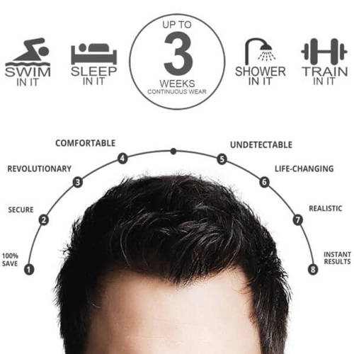 French Lace Hair System (Q6) - The Invisible Hairline Solution 5