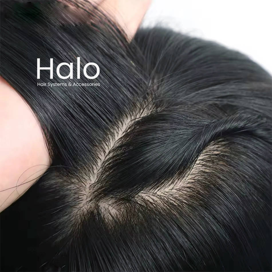 Australia Mirage Hair Patch 5