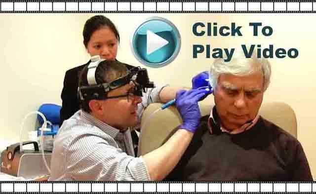 Ear wax removal with microsuction in Cleveland