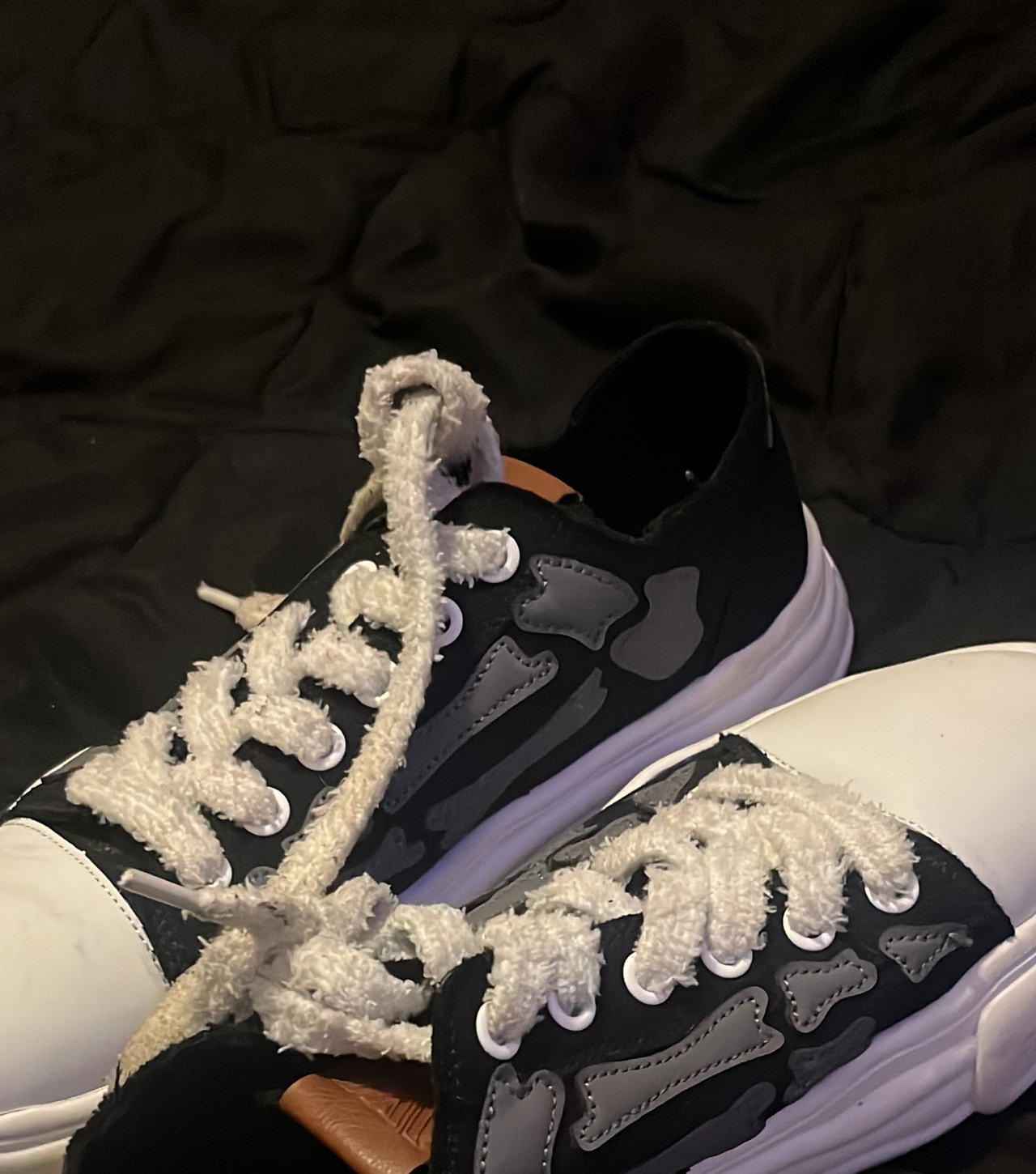 Amiri Skel Top Low sneaker in a black and white skeleton design