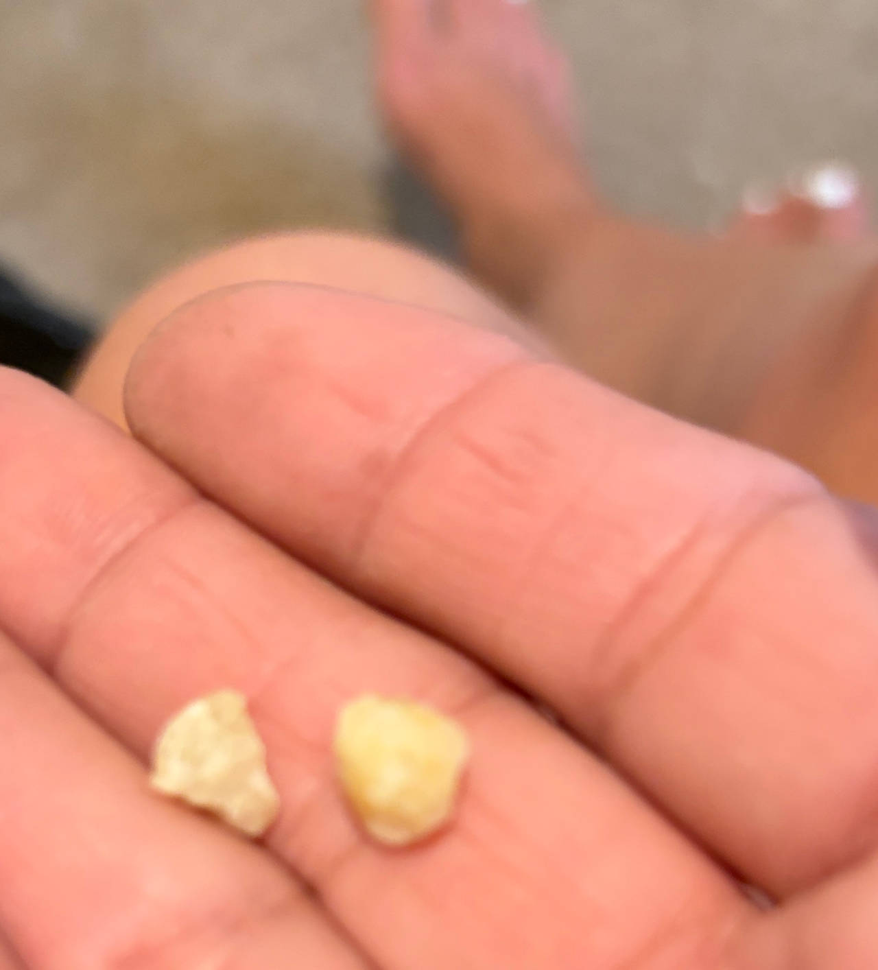 Frankincense Resin Tears