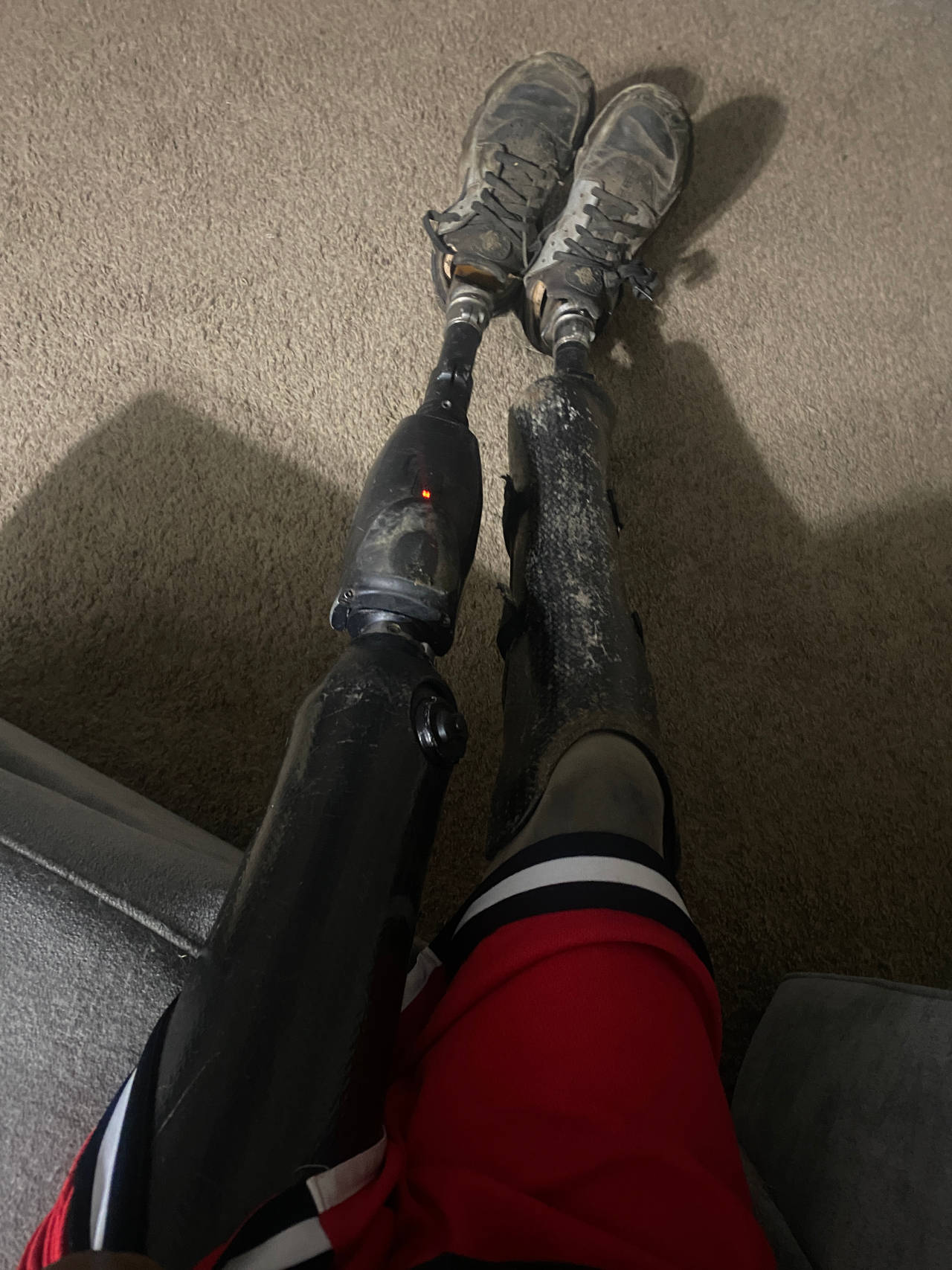 prosthetic leg