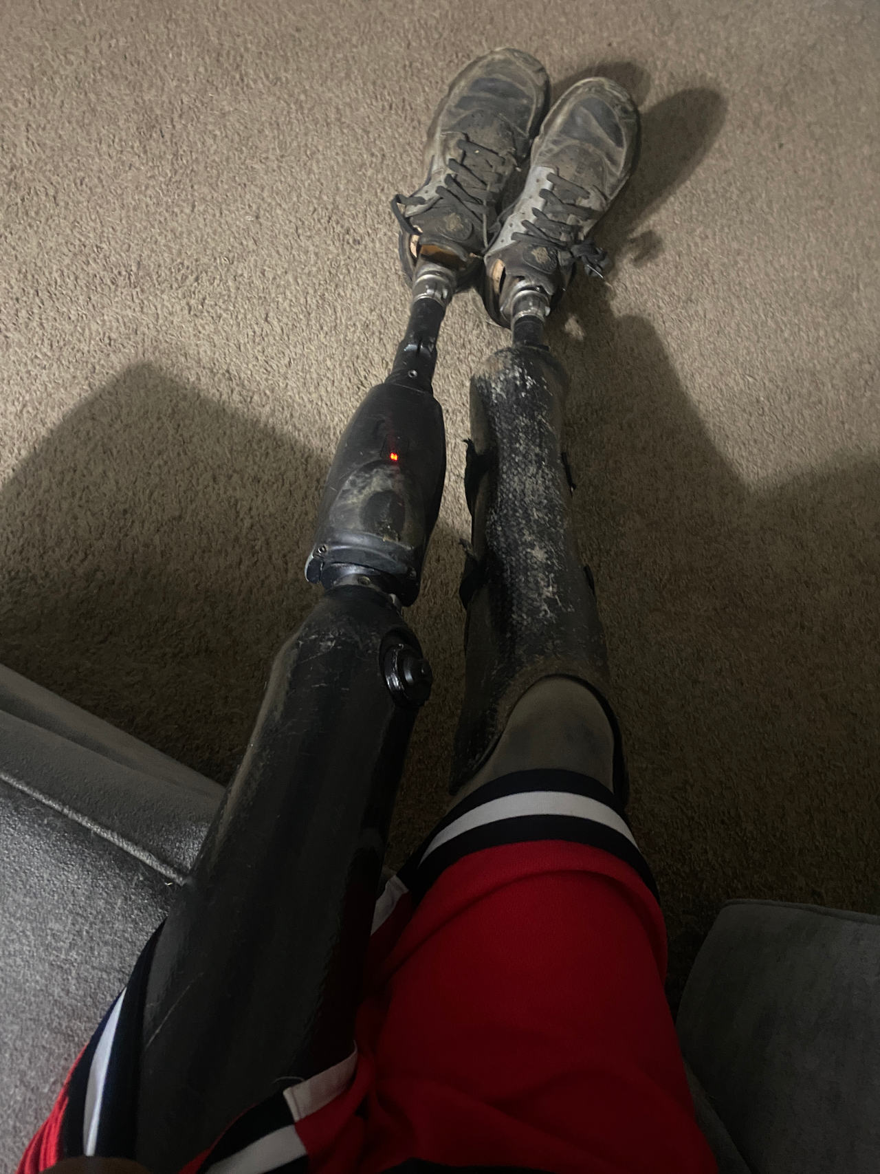 prosthetic leg