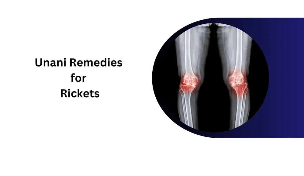 unani-remedies-for-rickets-all-cures
