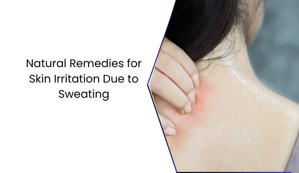 Skin Rash Sweating Infection Natural Remedies for Skin Irritation Due to Sweating | All-Cures