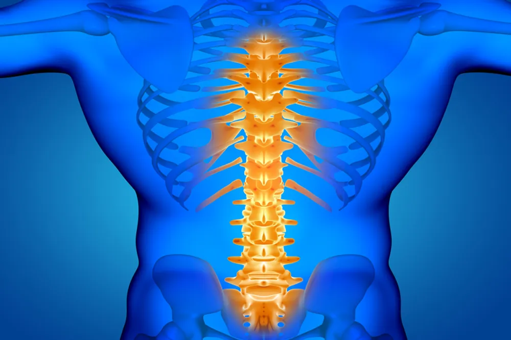 Ayurveda Treatment For Cauda Equina Syndrome | All-Cures