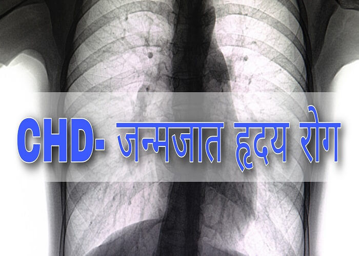 congenital heart disease symptoms and treatment in hindi