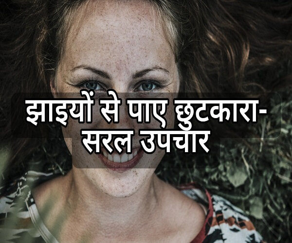 Freckles on the face - what a stain on beauty in hindi