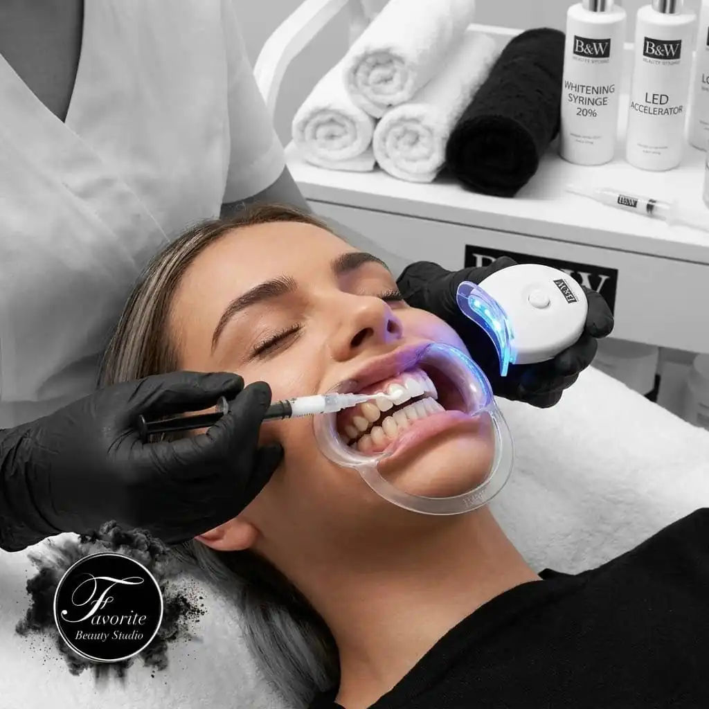 Blanqueamiento Dental