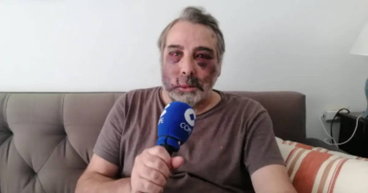 Vecino es agredido en su propia casa tras pedir silencio a un grupo de jóvenes dominicanos