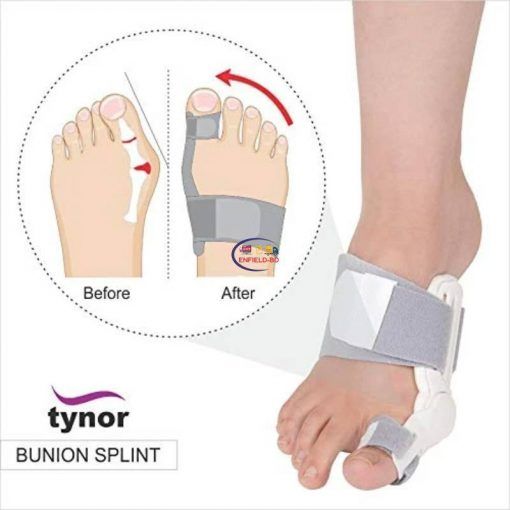 Tynor Bunion Splint K-14 I Universal Enfield-bd.com
