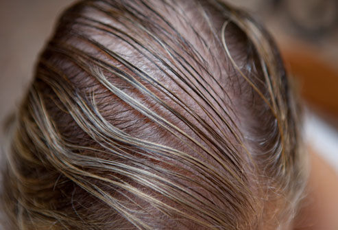 best treatment for thinning hair