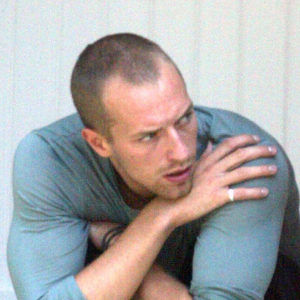 Chris Martin Hair Transplant Hair Transplant Dubai