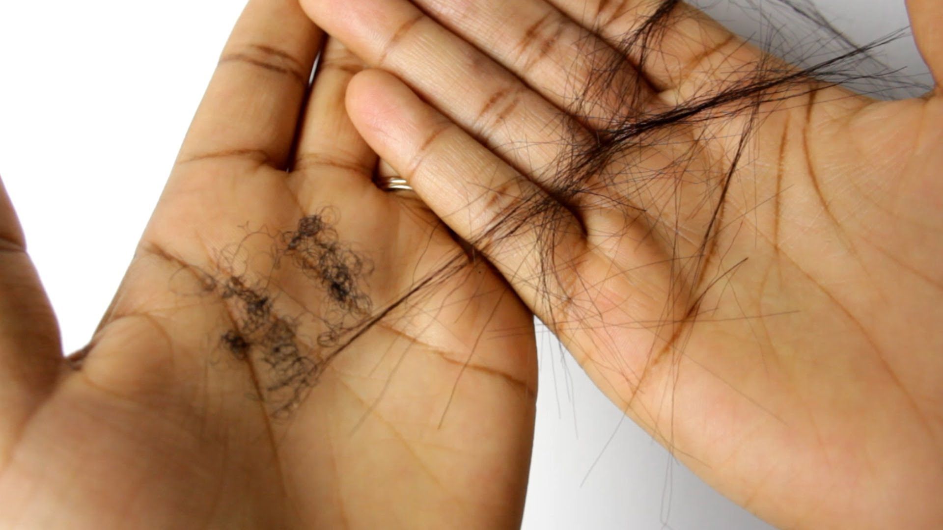 How To Stop Damaging Your Hair Hair Transplant Dubai