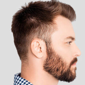 beard-transplant