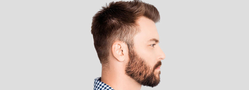 beard-transplant