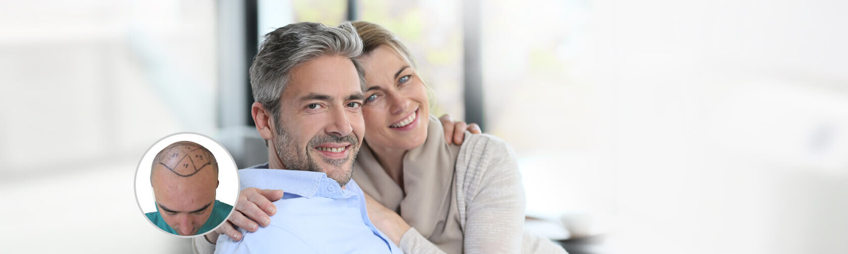 Hair transplant in Dubai Hair transplant in Dubai