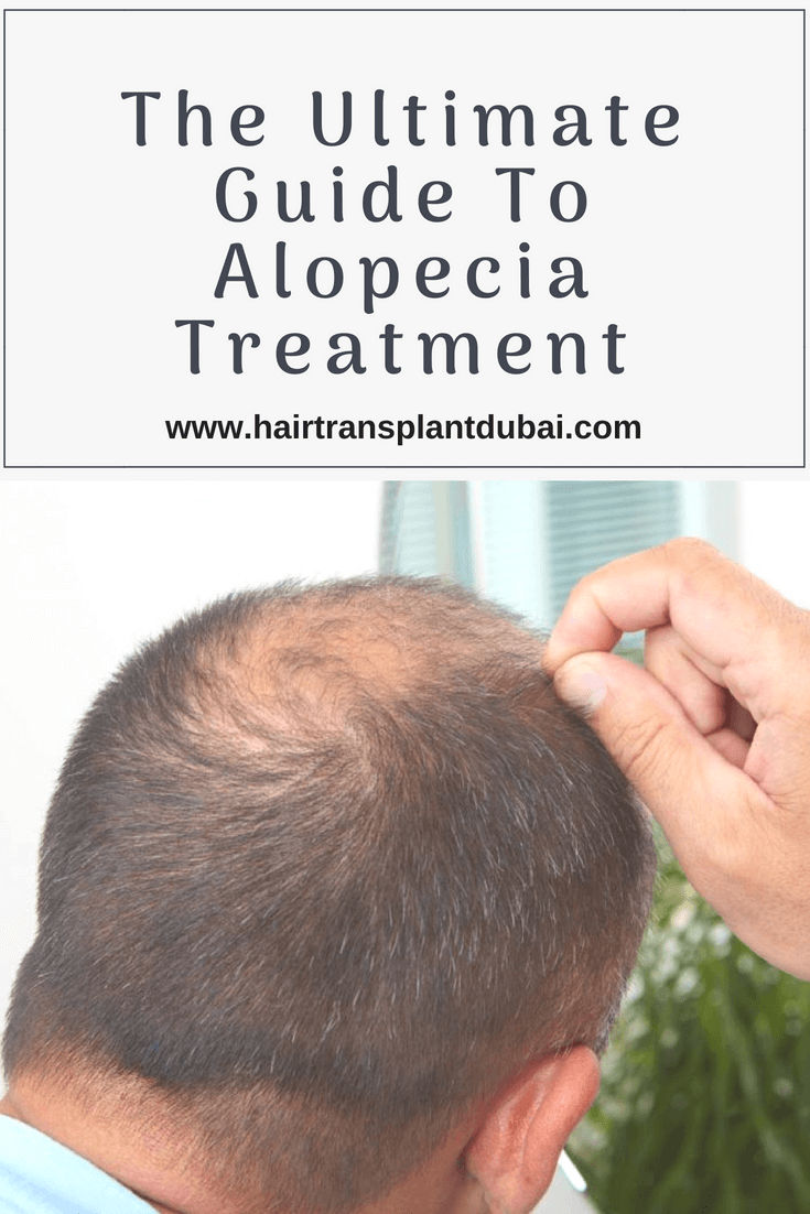 Ultimate Guide To Alopecia Treatment Hair Transplant Dubai