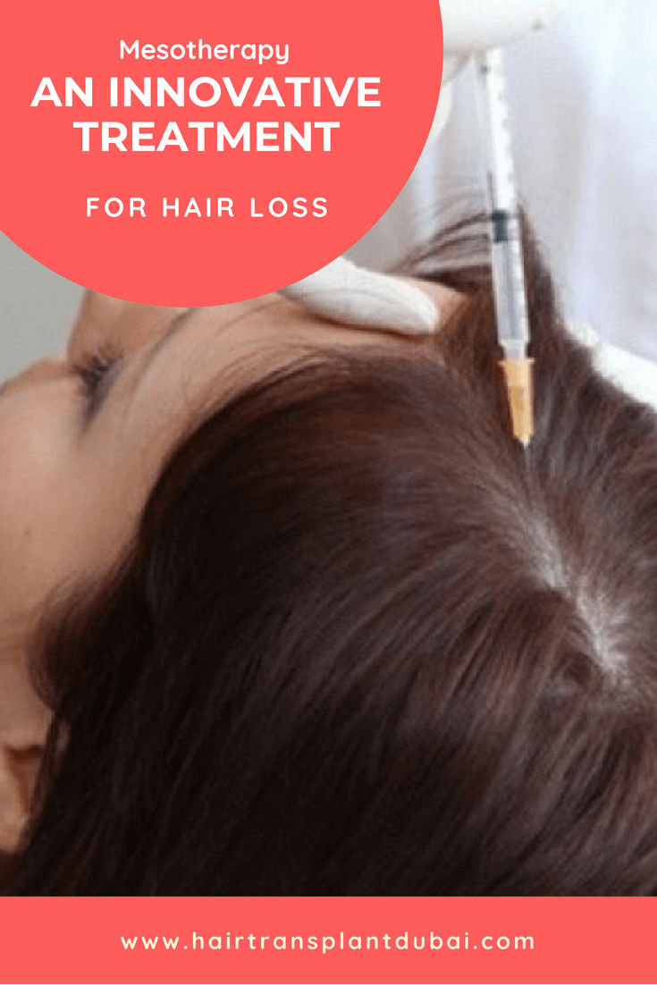 Mesotherapy: An Innovative Treatment for Hair Loss | Hair ...