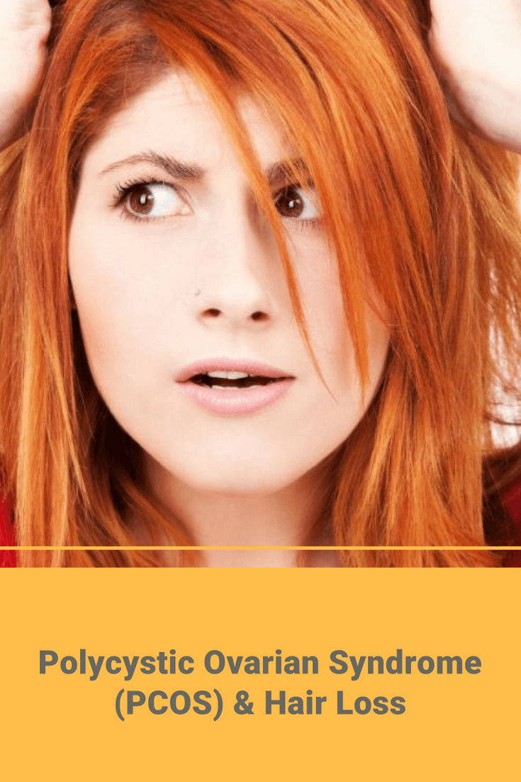 Polycystic Ovarian Syndrome Pcos Hair Loss Hair Transplant Dubai