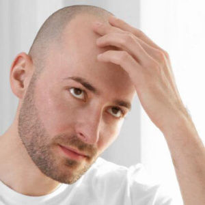 Investing in Hair Transplant? Here are some great benefits