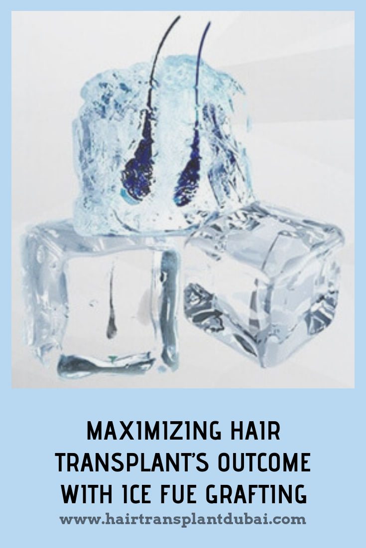 Maximizing Hair Transplant’s with Ice FUE grafting Hair