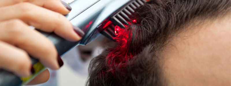 Laser Hair Therapy for Hair Loss in Dubai, Abu Dhabi & Sharjah